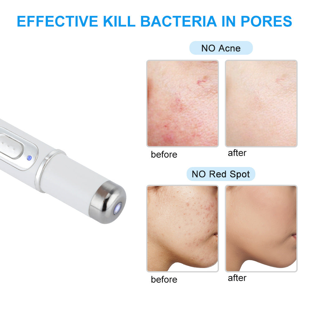 Spot Blue Light Acne Pen Eye Massager To Remove Eye Bags And Fade Dark Circles Massage Stick Beauty Eye Instrument