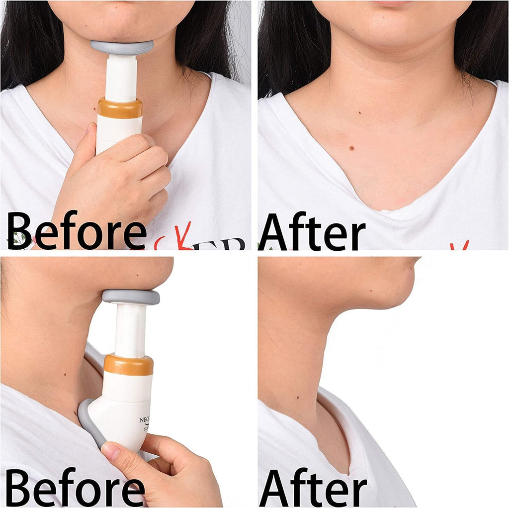 Chin Fat Burner/Massager