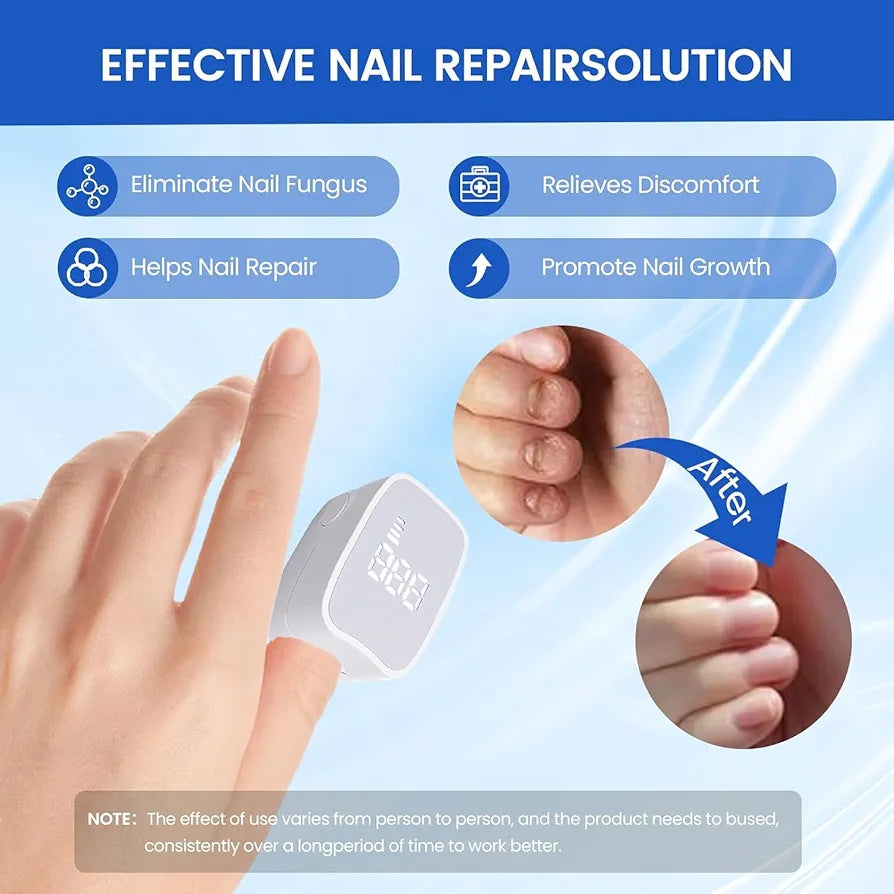 Ultraviolet Manicure Machine-Fungus Cleaning