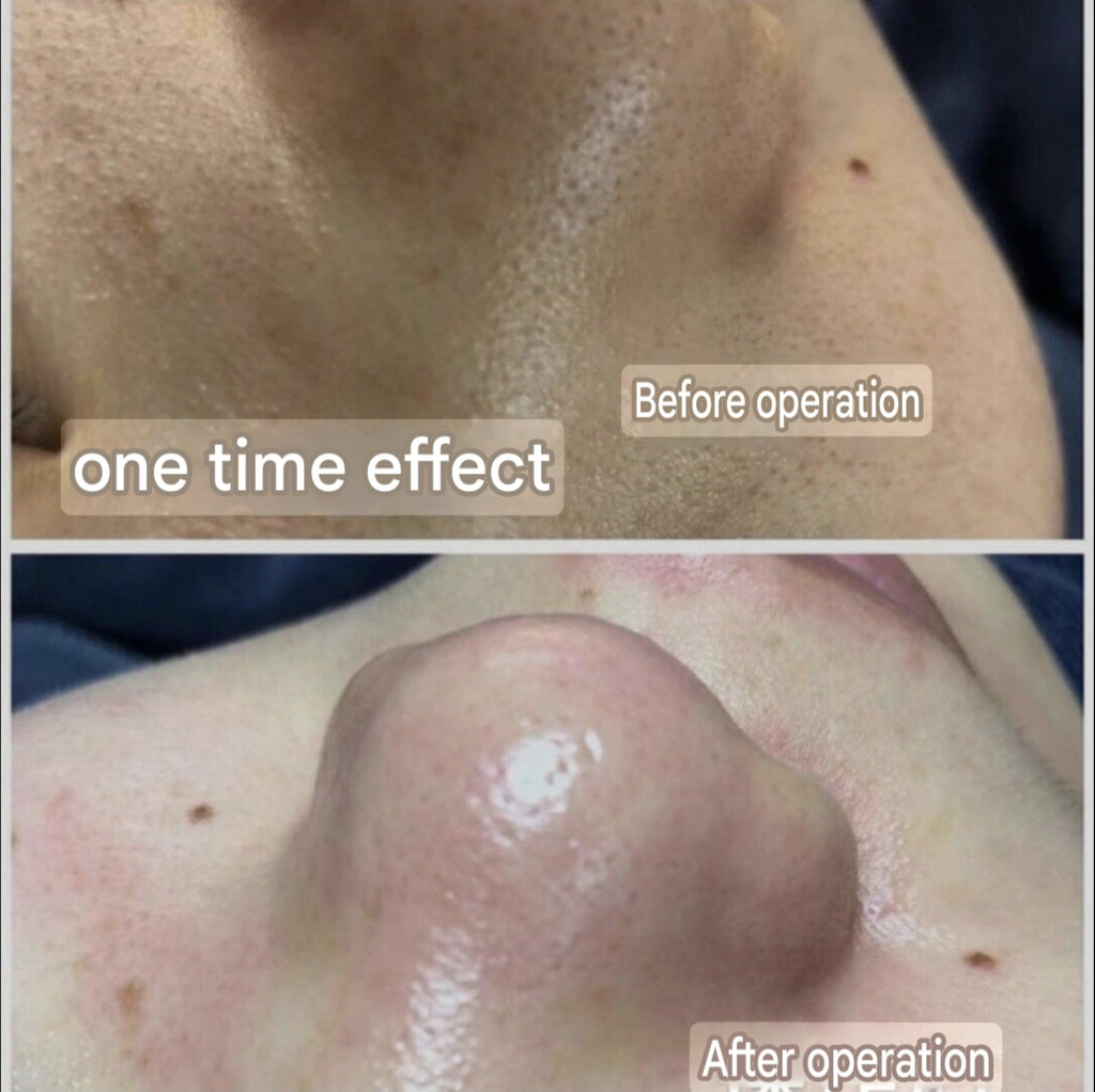 Hair Follicle Cleansing Cream