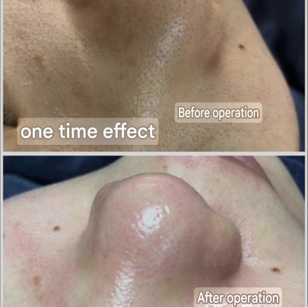 Hair Follicle Cleansing Cream