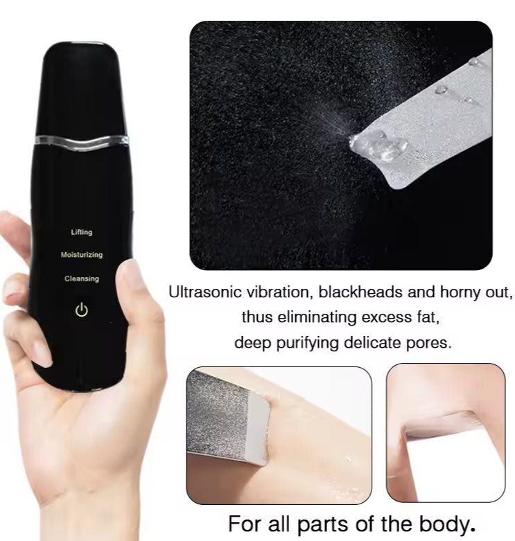 Ultrasonic Blackhead Remover