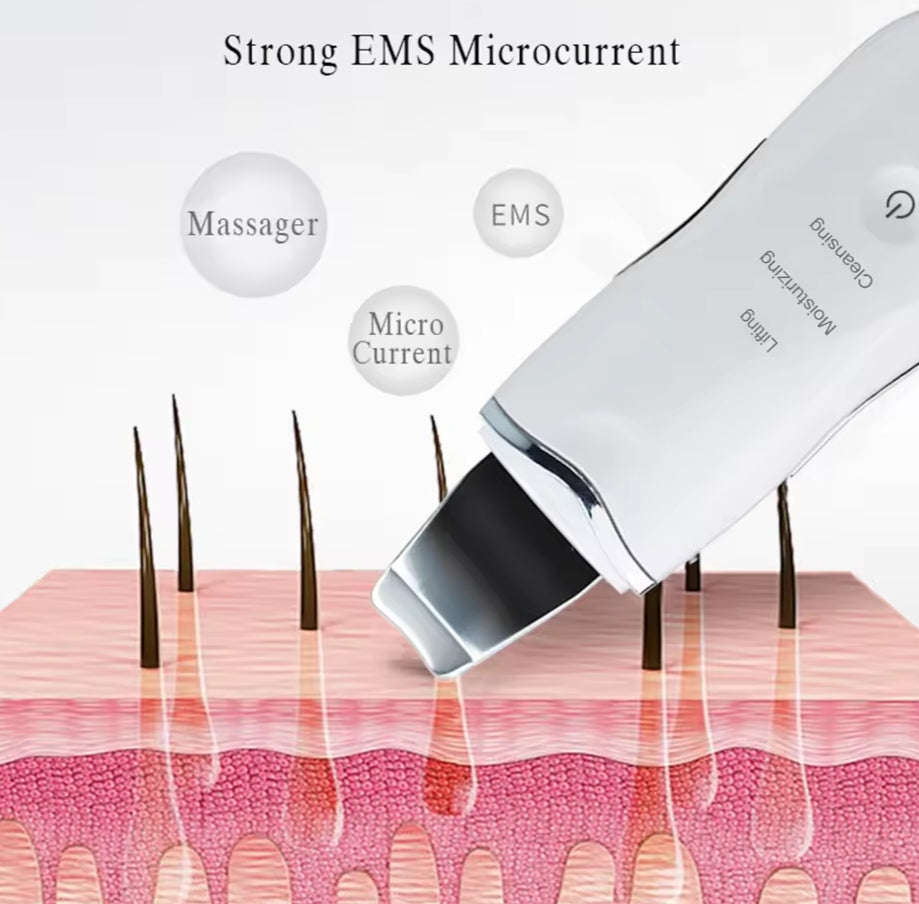 Ultrasonic Blackhead Remover