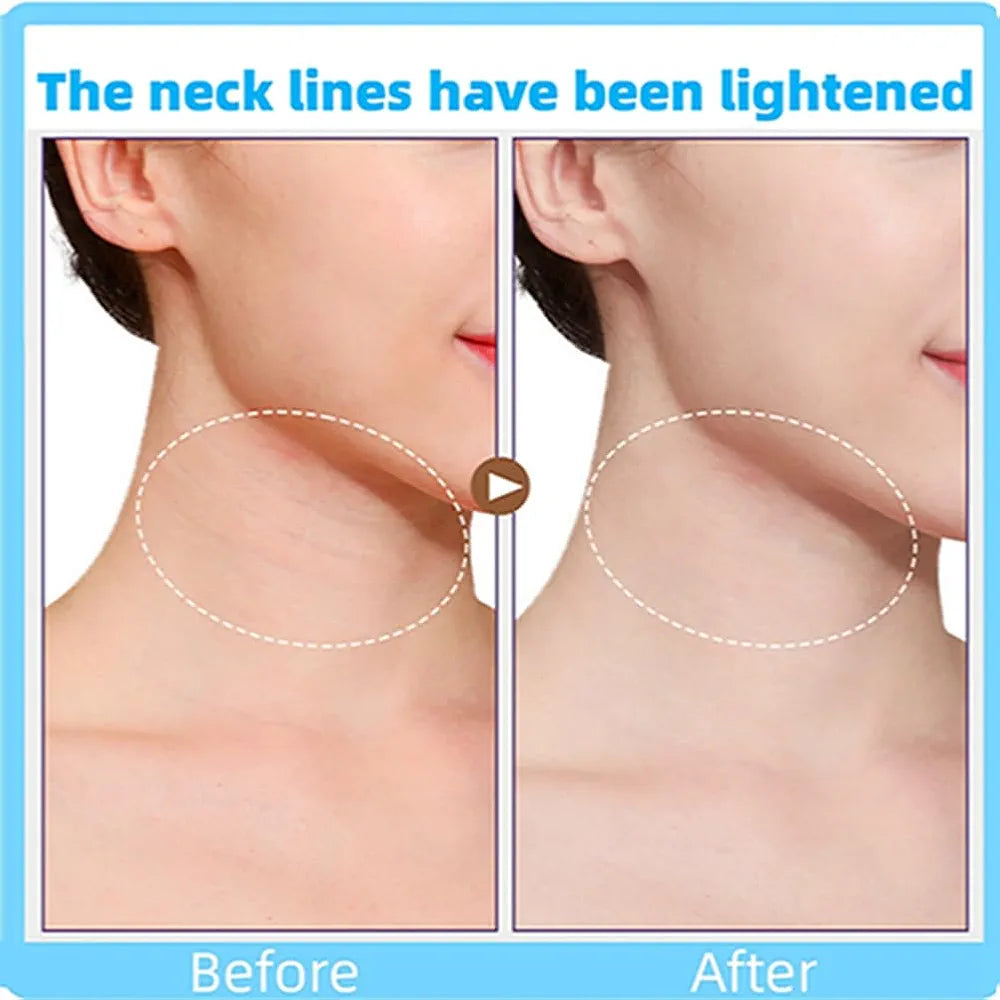 Neck Line Lifting Patch
