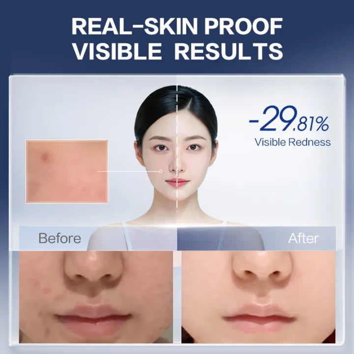 Proya Skin Care