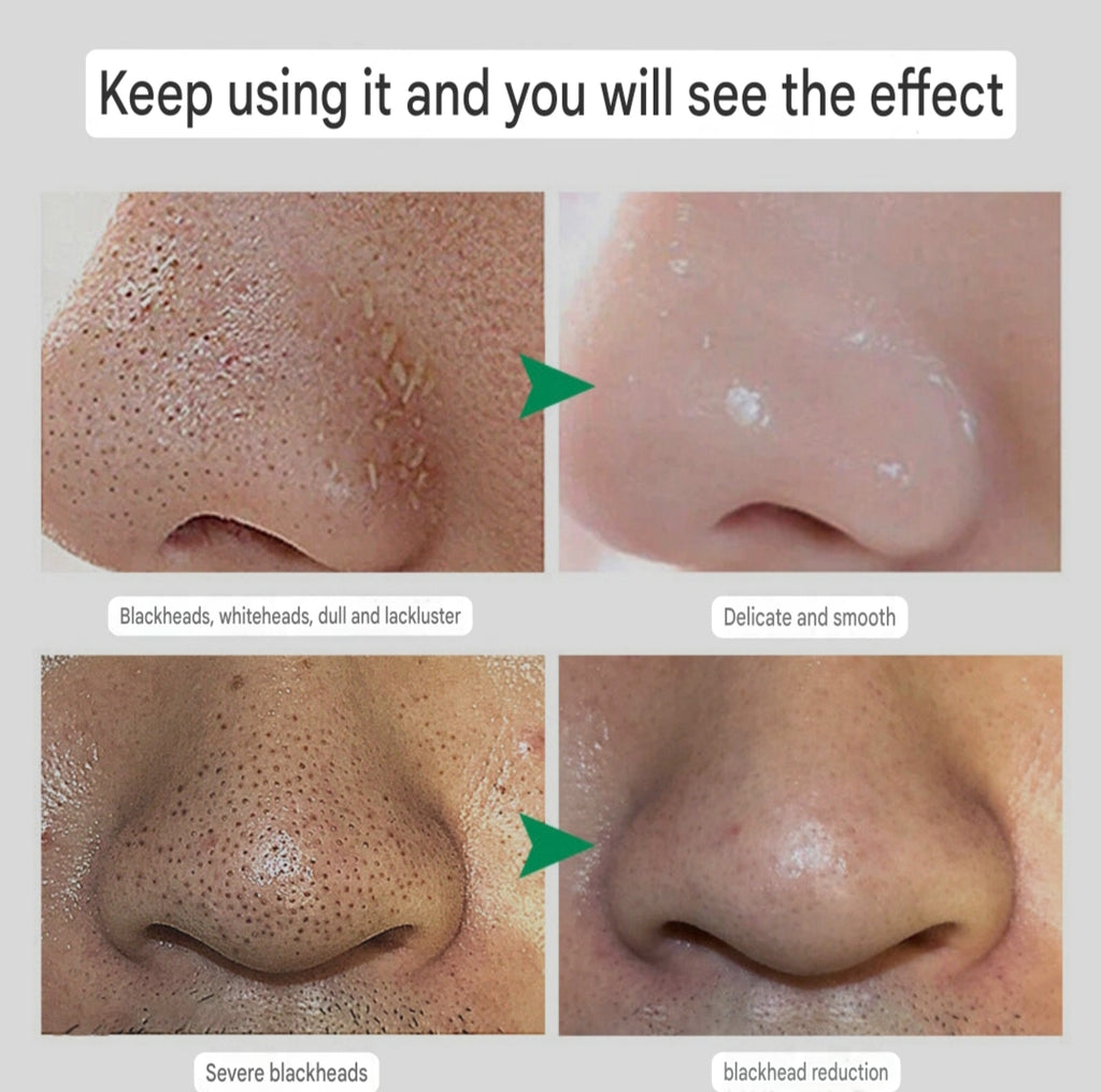 Hair Follicle Cleansing Cream