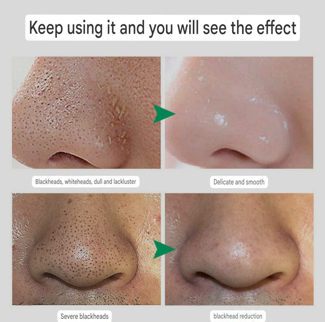 Hair Follicle Cleansing Cream